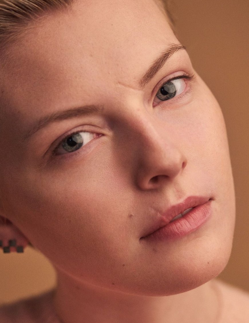 Glam Aesthetics – Redefining Facial Scar Treatment in Islamabad