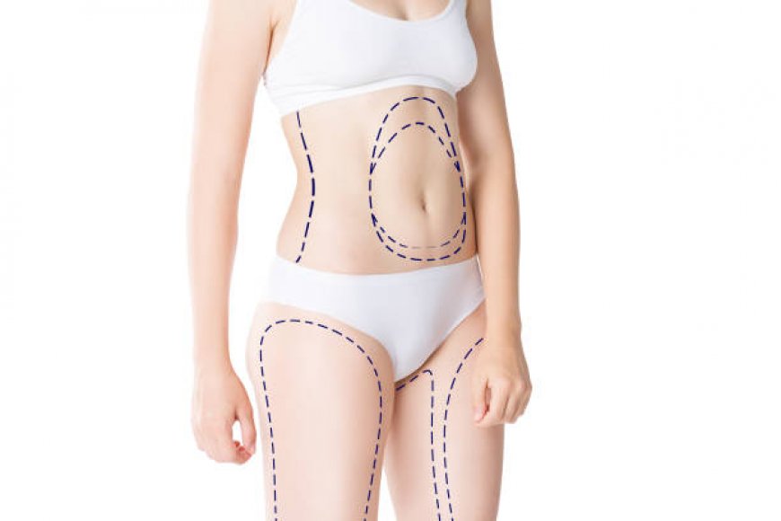 How Thigh Lift Surgery in Riyadh Enhances Body Contour