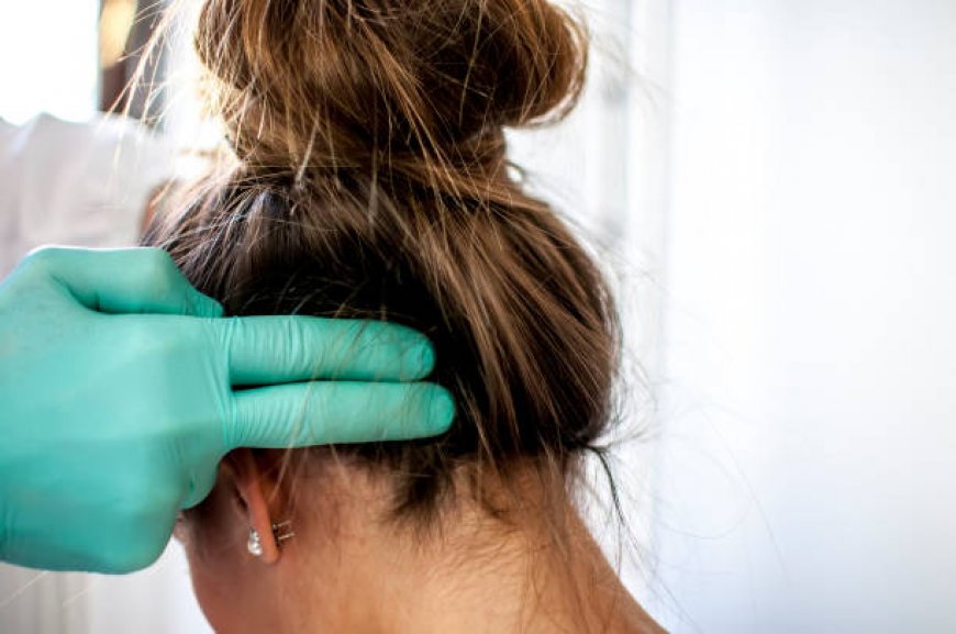 Hair Thinning? Try Exosome Therapy in Riyadh Today!