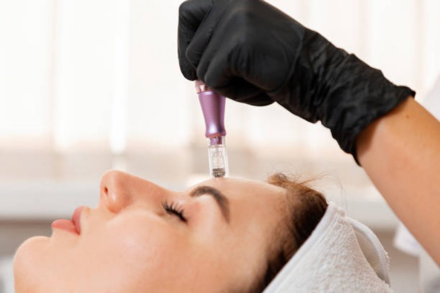 Derma Pen for Wrinkles: Safe Anti-Aging Option