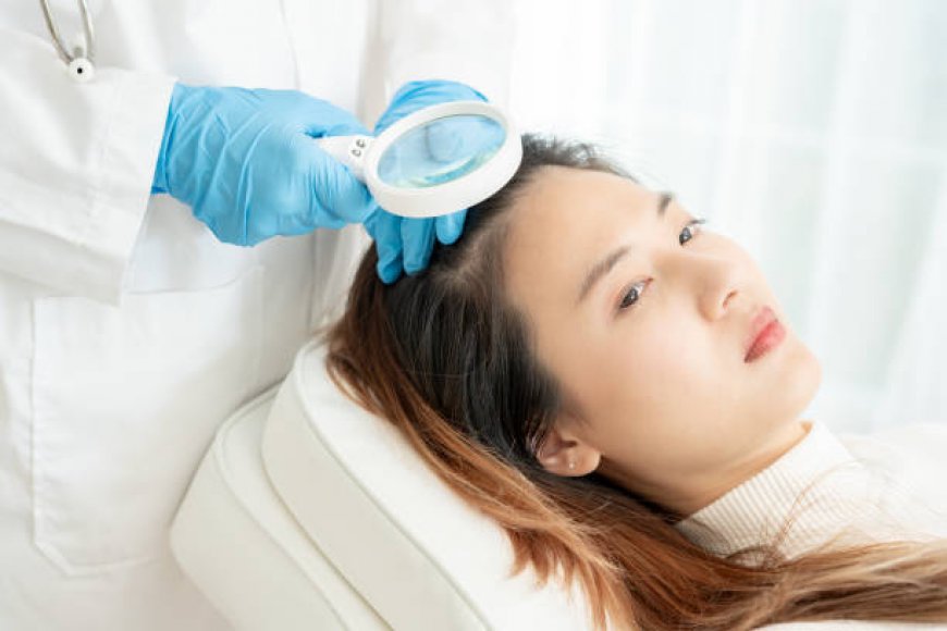 From Hair Loss to Hair Growth: How Exosomes Therapy in Riyadh Works