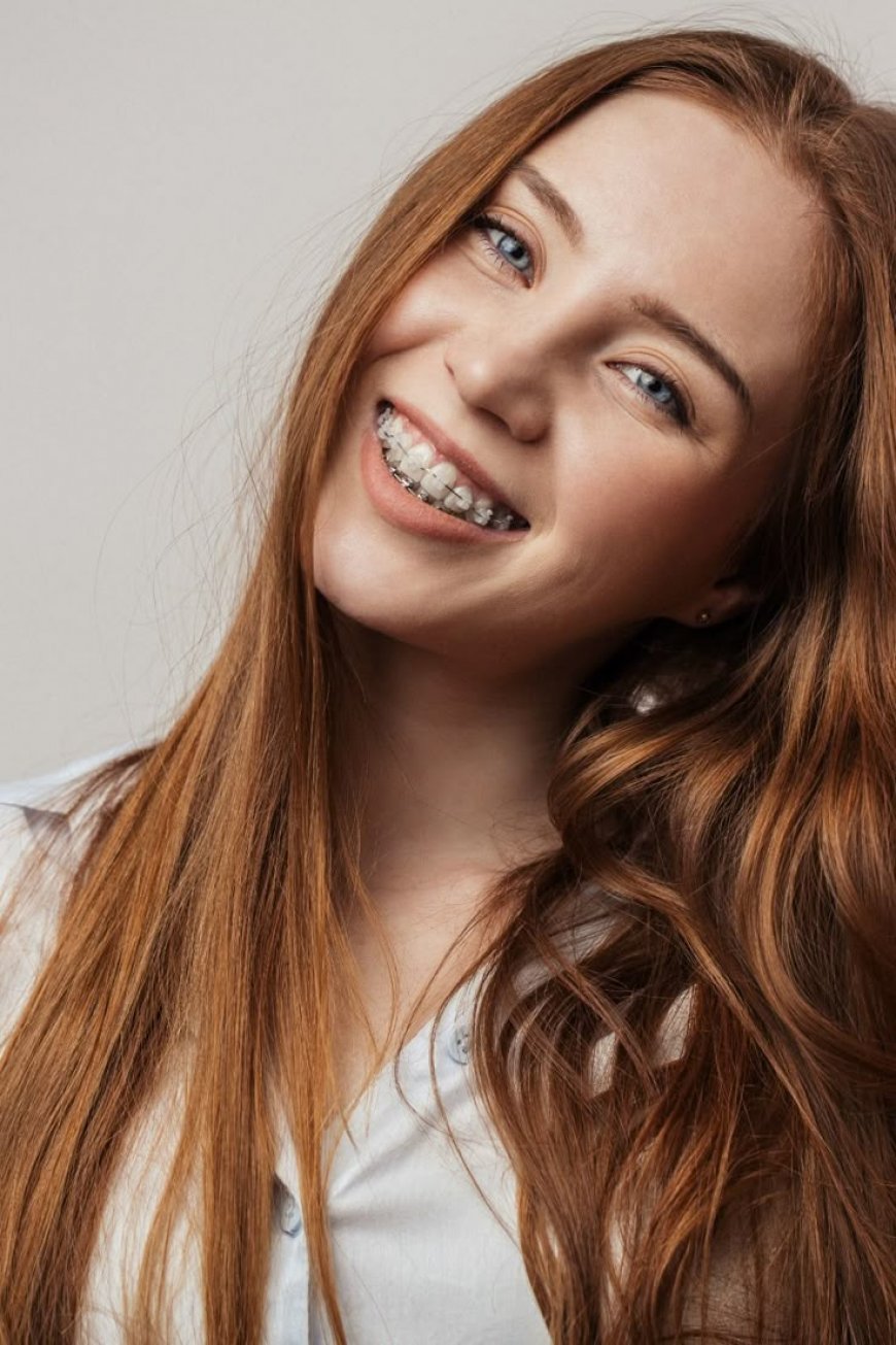 Dental Braces in Islamabad – Transform Your Smile with Enfield Royal Clinic