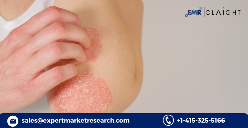 Plaque Psoriasis Drug Pipeline Analysis: Market Expansion and Future Growth (2034)