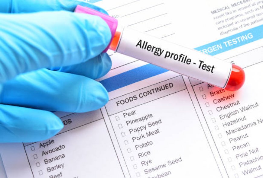 Understanding Food Allergy Testing and Its Benefits