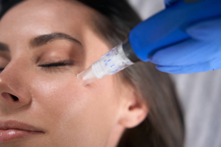What to Expect After a Derma Pen Session