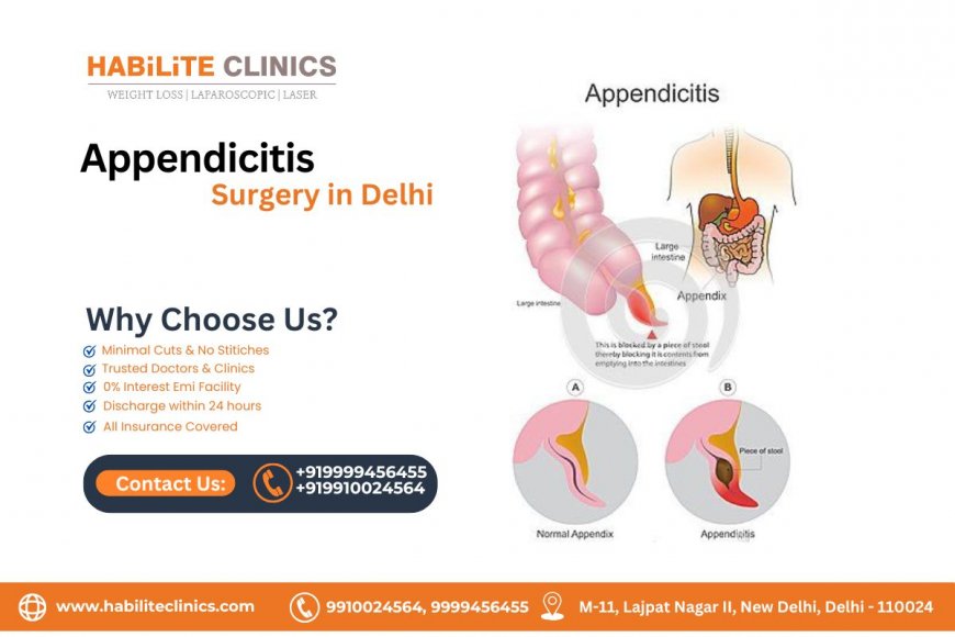 How to Check for Appendicitis At Home