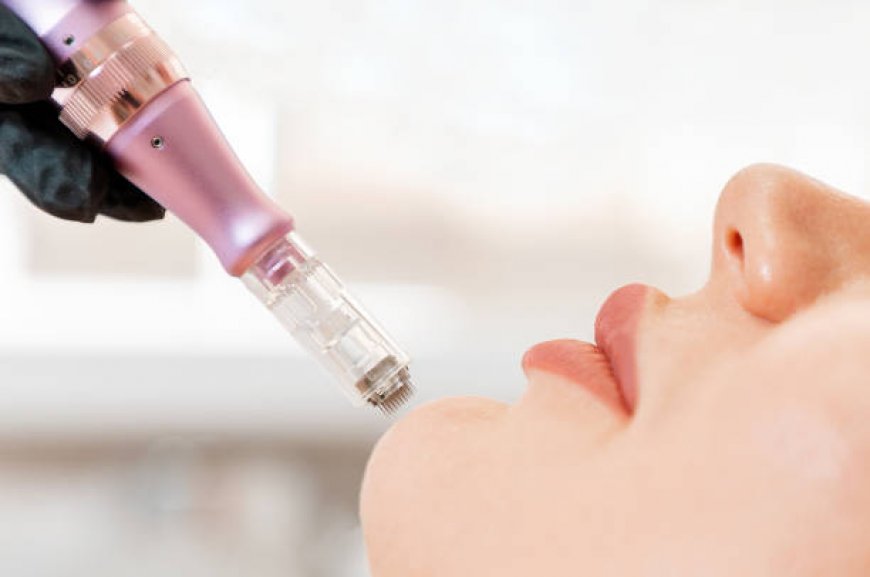 Derma Pen vs. Traditional Microneedling Tools
