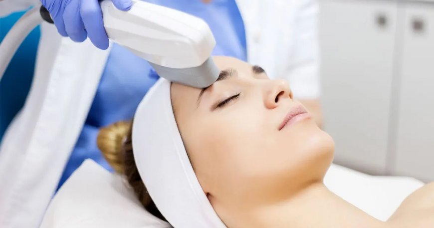 Understanding the Different Types of Laser Treatments for Acne Scars