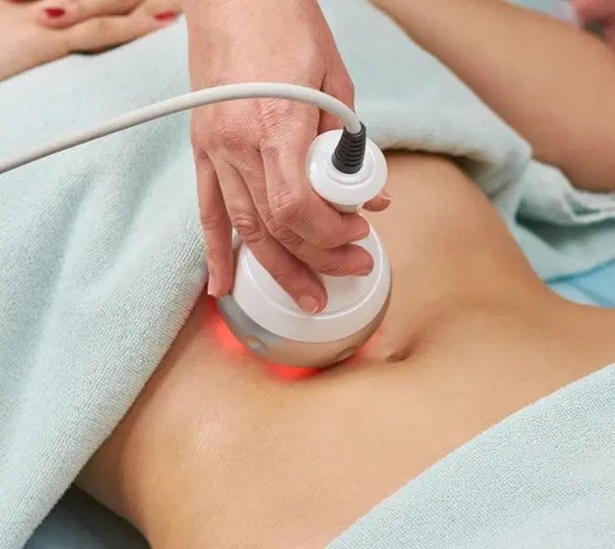 Smooth Your Skin with Proven Cellulite Treatments