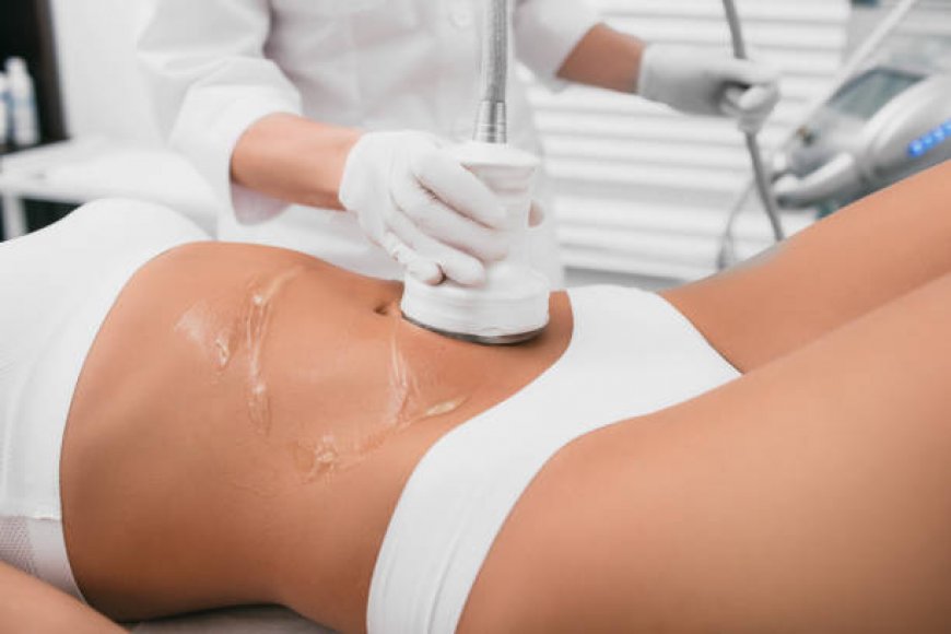 Liposuction in Riyadh: A Complete Guide
