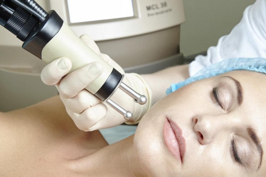 Experience Skin Transformation via Fractional Laser