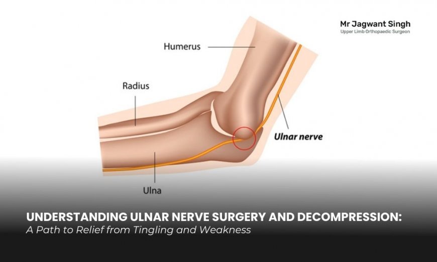 Ulnar Decompression Surgery & Ulnar Nerve Surgery – Understanding Treatment, Recovery and Benefits
