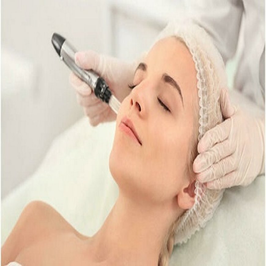 What Is Derma Roller Treatment and How Does It Work?