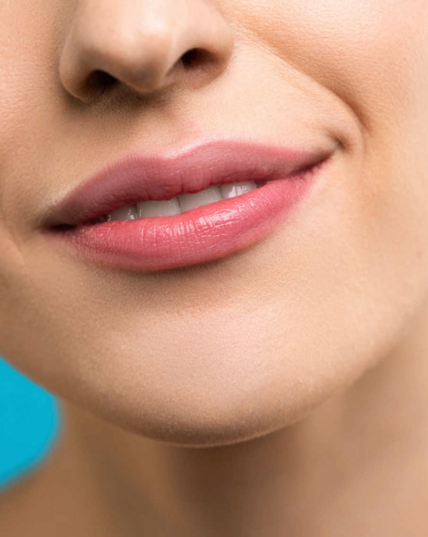 Lip Fillers vs. Lip Implants: Which One is Right for You?