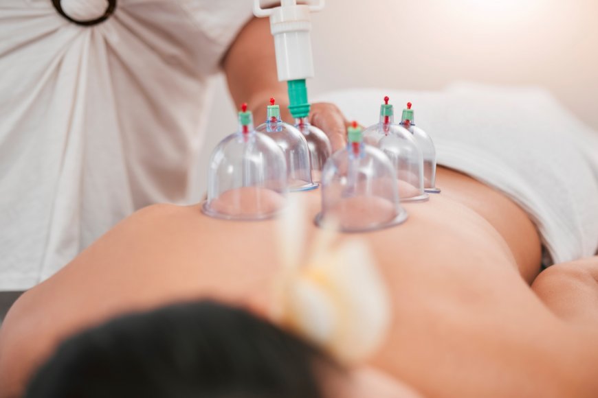 Can Hijama Aid in Weight Loss? Here’s What You Should Know