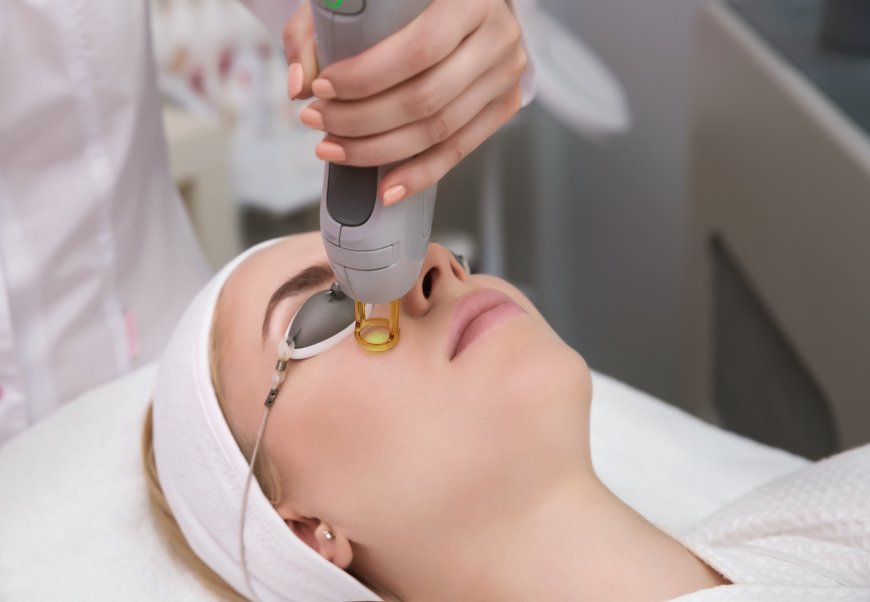 Fractional Laser: A New Era in Skincare