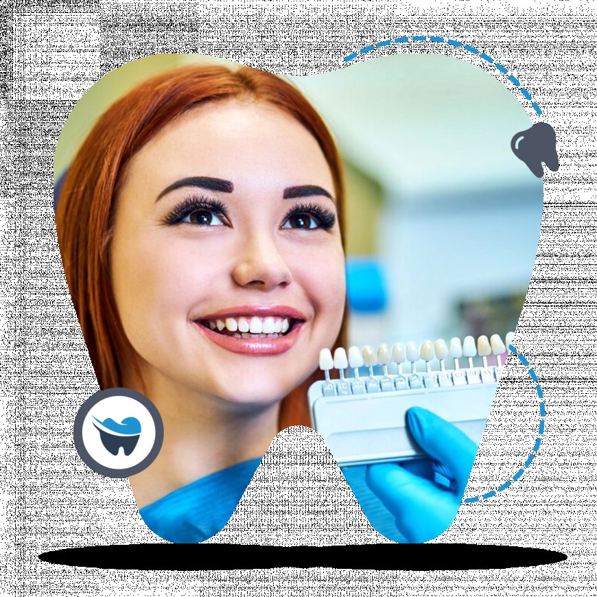 Transform Your Smile with Dental Veneers in Perth: What You Need to Know Before You Book