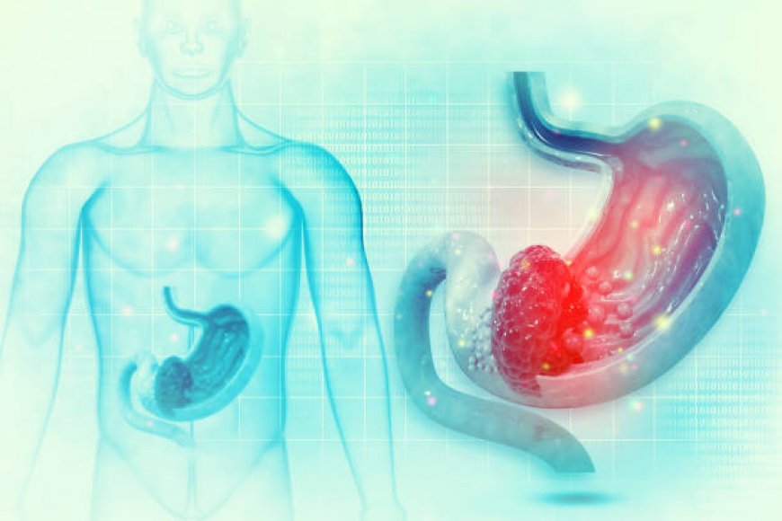Effective Weight Loss with Gastric Balloon in Riyadh