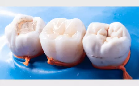 From Diagnosis to Solution: How Same Day Fillings Work
