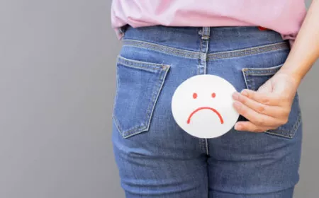 Hemorrhoid Treatment in Riyadh: Your Guide to Healing