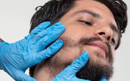 Beard Hair Transplant: Cultural Perspectives