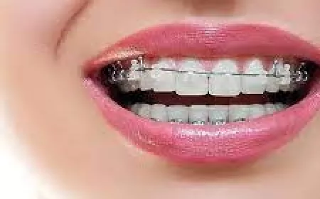 Do Braces Cause Bad Breath?