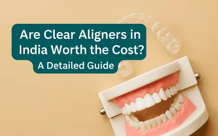 Are Clear Aligners in India Worth the Cost? A Detailed Guide