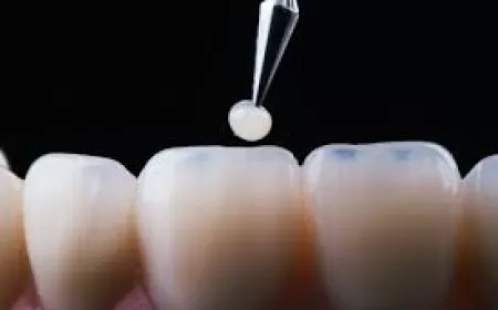 What to Do If Your Bonding Feels Loose?