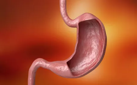 Riyadh Gastric Balloon Benefits: A Non-Surgical Path to Weight Loss