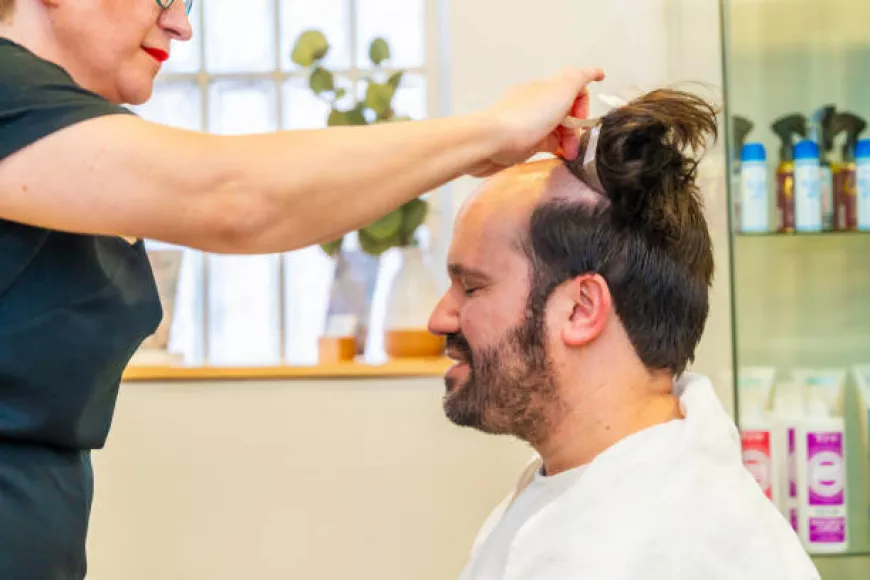 Restore Confidence with FUE Hair Transplant Riyadh