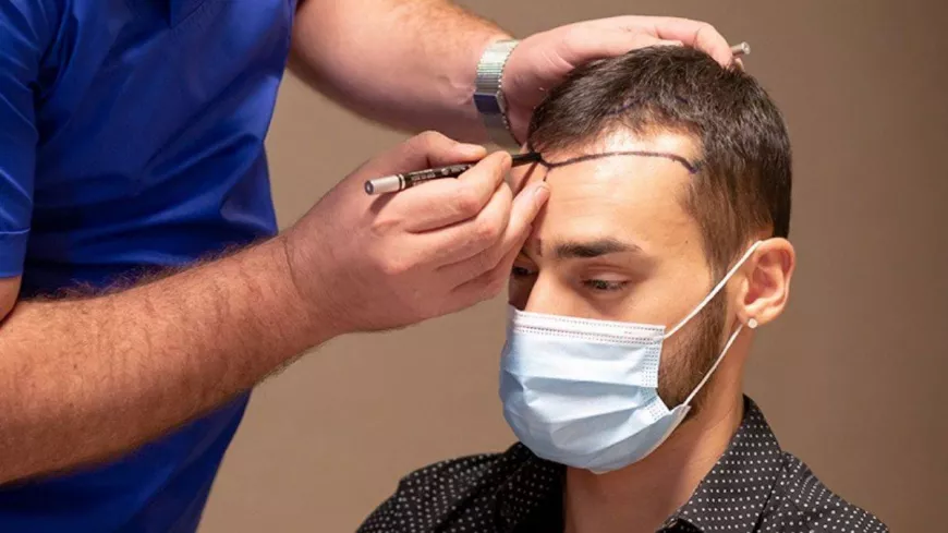 Summer Hair Care After a Hair Transplant