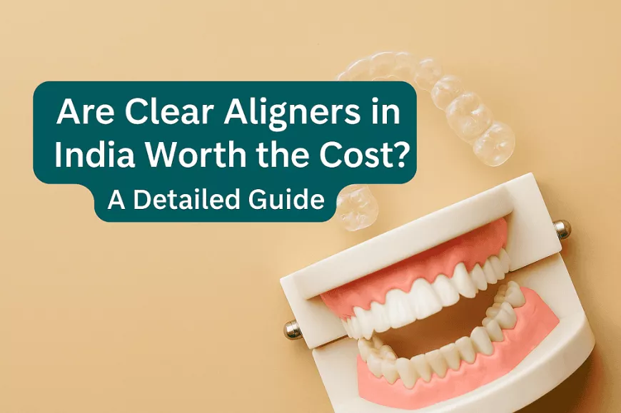 Are Clear Aligners in India Worth the Cost? A Detailed Guide