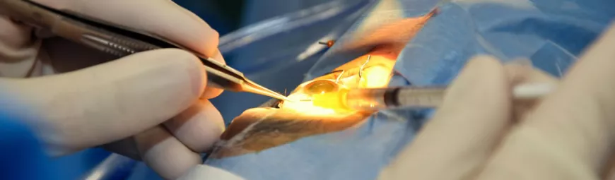 How to Choose the Right Ophthalmologist in Dubai for Your Eye Condition