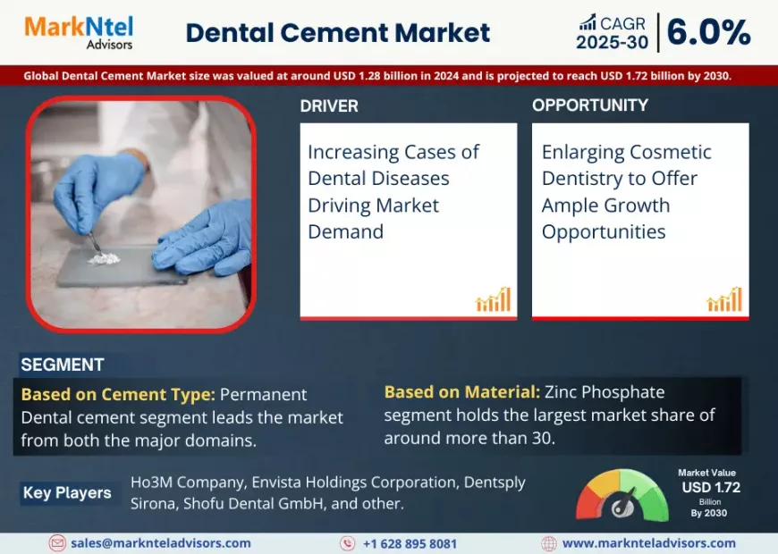 Dental Cement Market Growth Forecast to 2030: Size & Demand Outlook