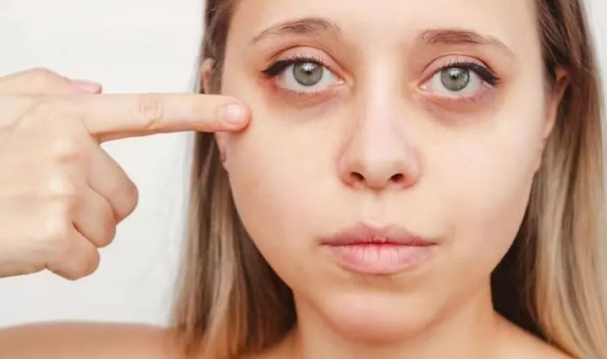 Night-Time Dark Circle Treatment Routine