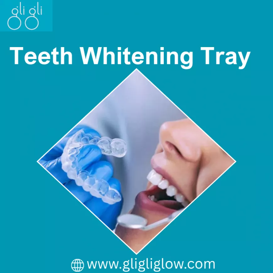 How a Teeth Whitening Tray Can Help You Get the Brightest Smile?