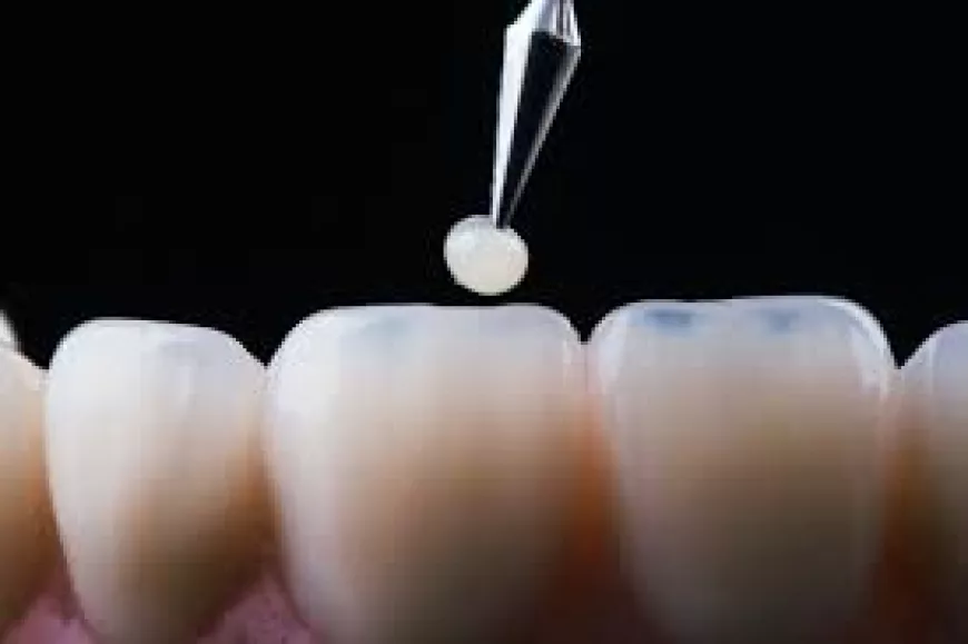 What to Do If Your Bonding Feels Loose?