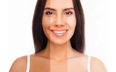 Which Area Offers the Best Skin Whitening in Islamabad?