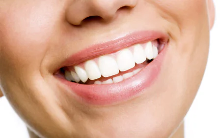 Is Teeth Whitening Safe?