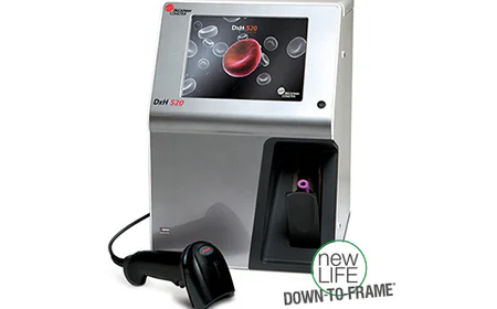 DXH520 Hematology Analyzer: Compact Solution for Mid-Volume Workflows