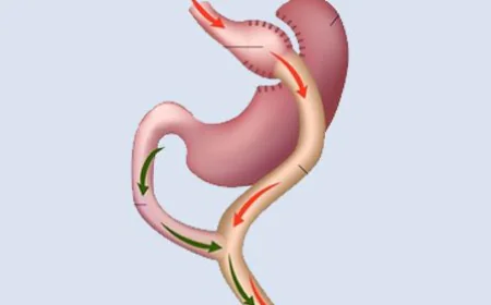 Affordable Gastric Balloon in Riyadh Options