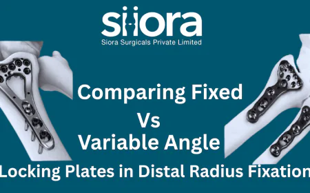 Comparing Fixed vs Variable Angle Locking Plates in Distal Radius Fixation