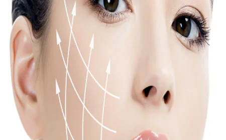 How Long Does a Thread Lift Last? Insights from Islamabad Experts