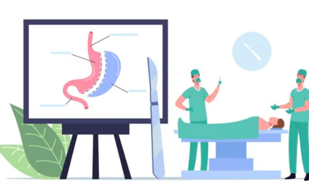 Appendix Removal Surgery: Recovery Time, Risks, and Costs Explained