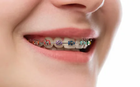 How Modern Orthodontics Is Reshaping Everyday Smile Confidence