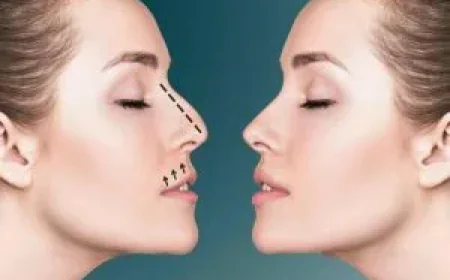 الفرق بين عملية تجميل الأنف الجراحية والغير جراحية