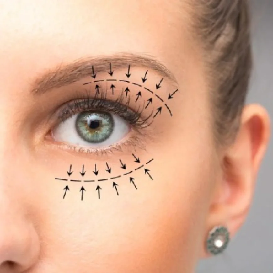 Eyelid Surgery in Islamabad: A Practical Choice for the Modern Lifestyle