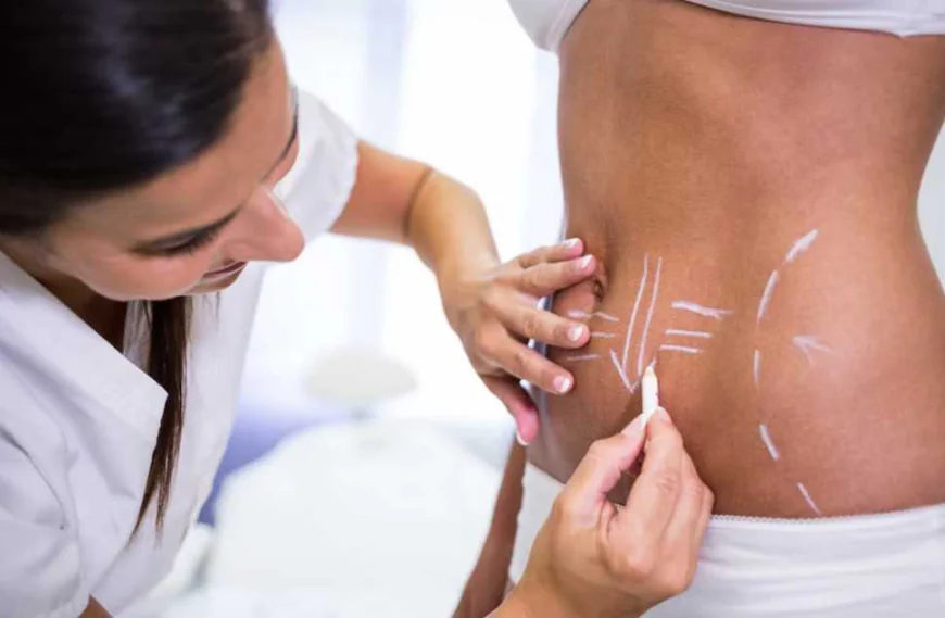 Guide to Safe Non-Surgical Fat Removal in Islamabad