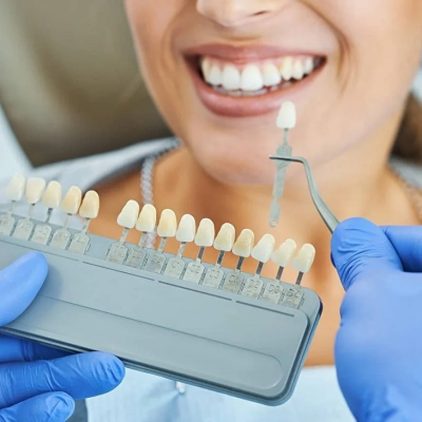 Dental Crowns: Protection and Beauty in One