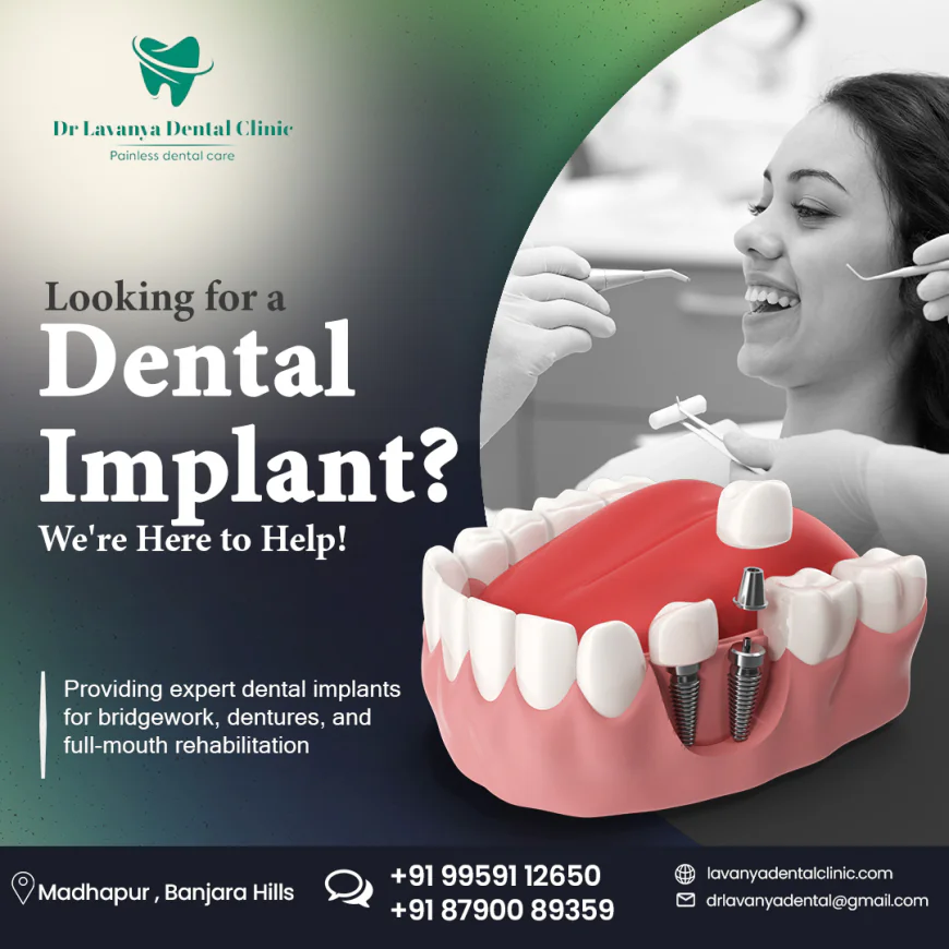 The Best Dental Clinic in Banjara Hills for Exceptional Oral Care